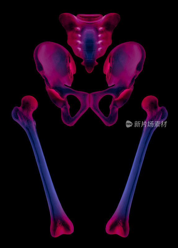 分开的人体髋和股骨前视图x光片疼痛区域红色突出- 3D医学和生物医学插图-医疗保健-人体解剖学和医学概念-蓝色调